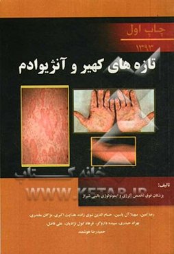 تازه‌های کهیر و آنژیوادم: به ضمیمه تازه‌های آلرژی