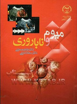 میوم و ناباروری