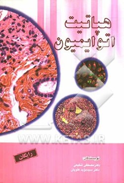 هپاتیت اتوایمیون