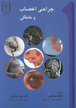 جراحی اعصاب و حاملگی