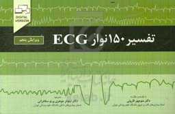 تفسیر 150 نوار ECG