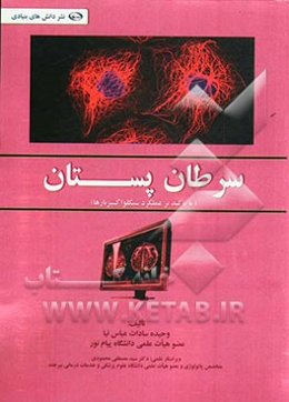 سرطان پستان (با تأکید بر عملکرد سیکلواکسیژنازها)