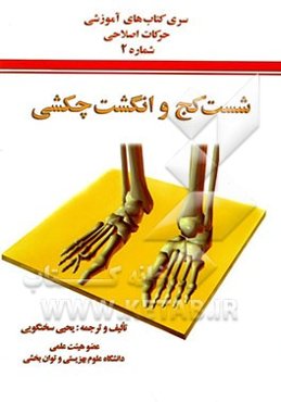 "شست کج" و "انگشت چکشی"