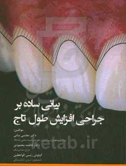 بیانی ساده بر جراحی افزایش طول تاج