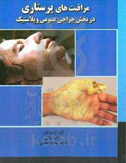 مراقبت‌های پرستاری در بخش جراحی عمومی و پلاستیک