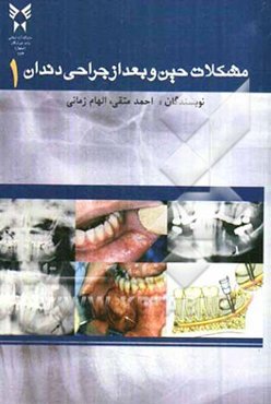 مشکلات حین و بعد از جراحی دندان