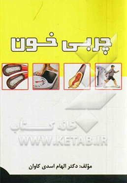 چربی خون (مرض قند)