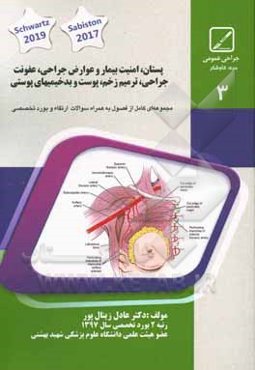 پستان، امنیت بیمار و عوارض جراحی، عفونت جراحی، ترمیم زخم، پوست و بدخیمی‌های پوستی خلاصه درس به‌همراه مجموعه سؤالات آزمون ارتقاء و بورد با پاسخ تشریحی