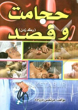 حجامت و فصد (رگ زدن)