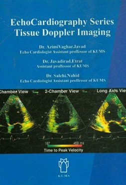 سری اکوکاردیوگرافی - تیشیوداپلر