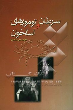 سرطان و تومورهای استخوان