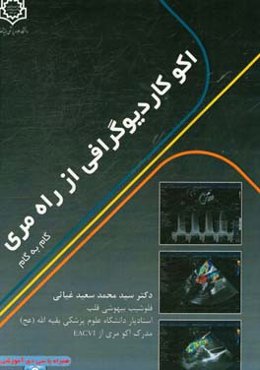 اکو کاردیوگرافی از راه مری: گام به گام