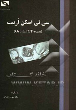 سی تی اسکن (Orbital CT-Scan)