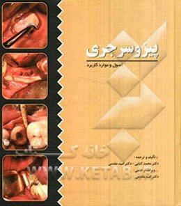 پیزو سرجری (اصول و کاربرد)