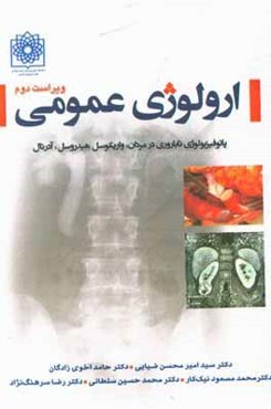 ارولوژی عمومی: پاتوفیزیولوژی ناباروری در مردان، واریکوسل هیدروسل، آدرنال