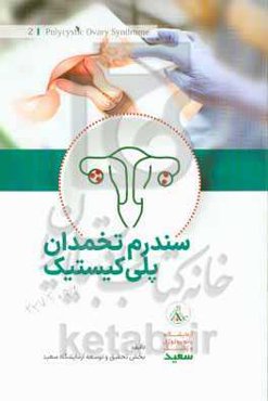 سندرم تخمدان پلی‌کیستیک