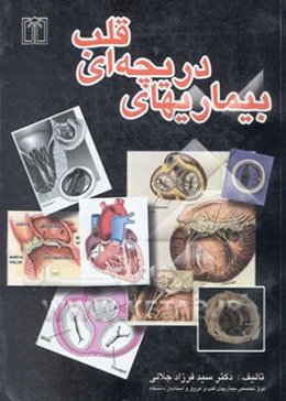 بیماریهای دریچه‌ای قلب