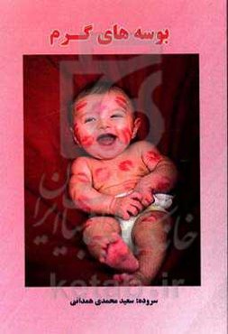 بوسه‌های گرم