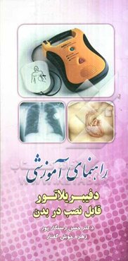 راهنمای آموزشی دفیبریلاتور قابل نصب در بدن
