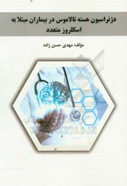 دژنراسیون هسته تالاموس در بیماران مبتلا به اسکلروز متعدد