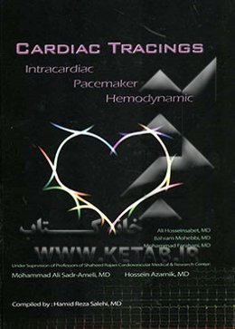 Cardiac tracings intracardiac pacemaker hemodynamic
