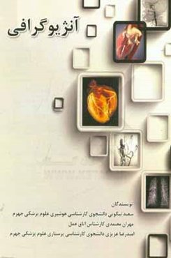 آنژیوگرافی