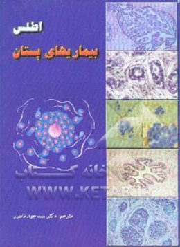 اطلس بیماریهای پستان