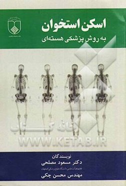 اسکن استخوان به روش پزشکی هسته‌ای