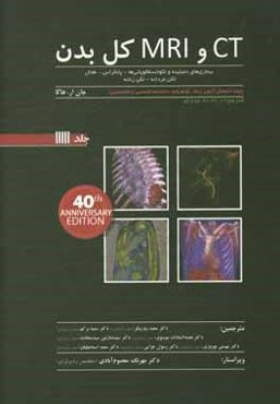‏‫CT و MRI کل بدن هاگا: بیماری‌های دمیلینه و لکوانسفالوپاتی‌ها - پانکراس - طحال...