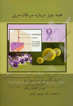 همه چیز درباره سرطان مری
