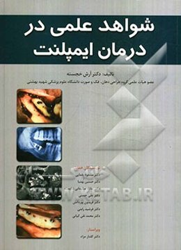 شواهد علمی در درمان ایمپلنت