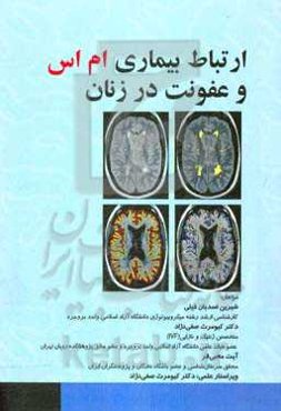 ارتباط بیماری ام اس و عفونت در زنان