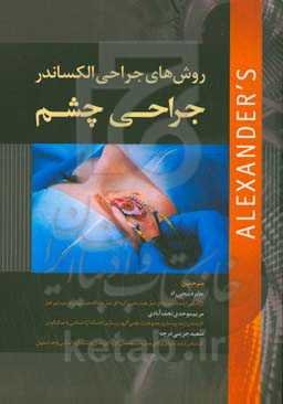 روش‌های جراحی الکساندر: جراحی چشم