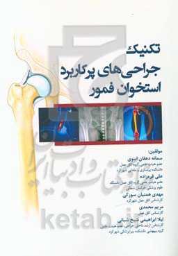 تکنیک جراحی‌های پرکاربرد استخوان فمور