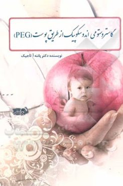 گاستروستومی اندوسکوپیک از طریق پوست (PEG)