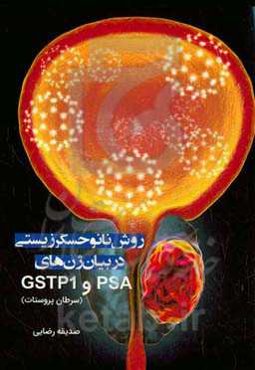 روش نانو حسگر زیستی در بیان ژن‌های PSA و GSTP1 (سرطان پروستات)