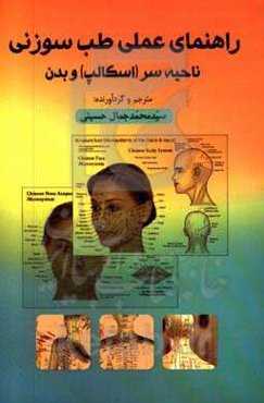 راهنمای عملی طب سوزنی ناحیه سر (اسکالپ) و بدن